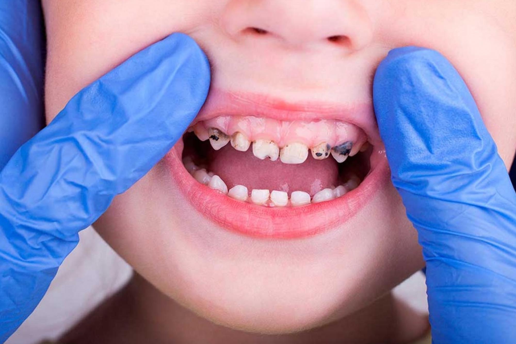 Налет Пристли