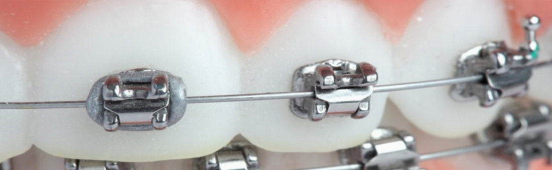 Ортодонтия