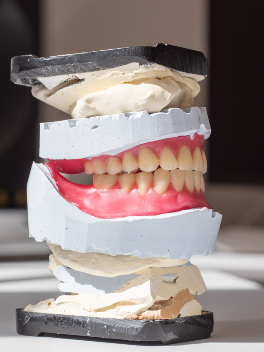 Протезирование