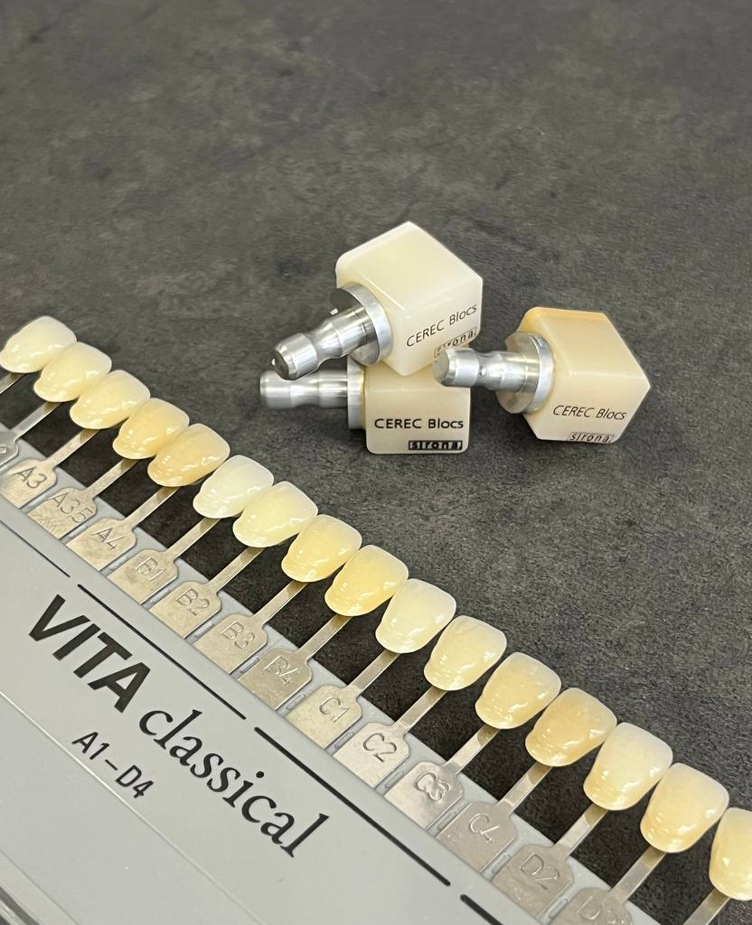 Коронка за одно посещение